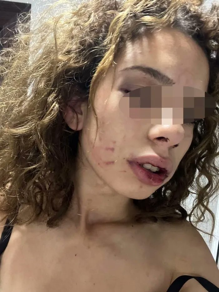 Konya'da 2 yıl önce tanıştığı 24 yaşındaki Hüseyin S.'den ayrılmak isteten 19 yaşındaki kız, şahıs tarafından öldüresiye dövüldü.

Şahıs adli kontrolle serbest bırakıldı.