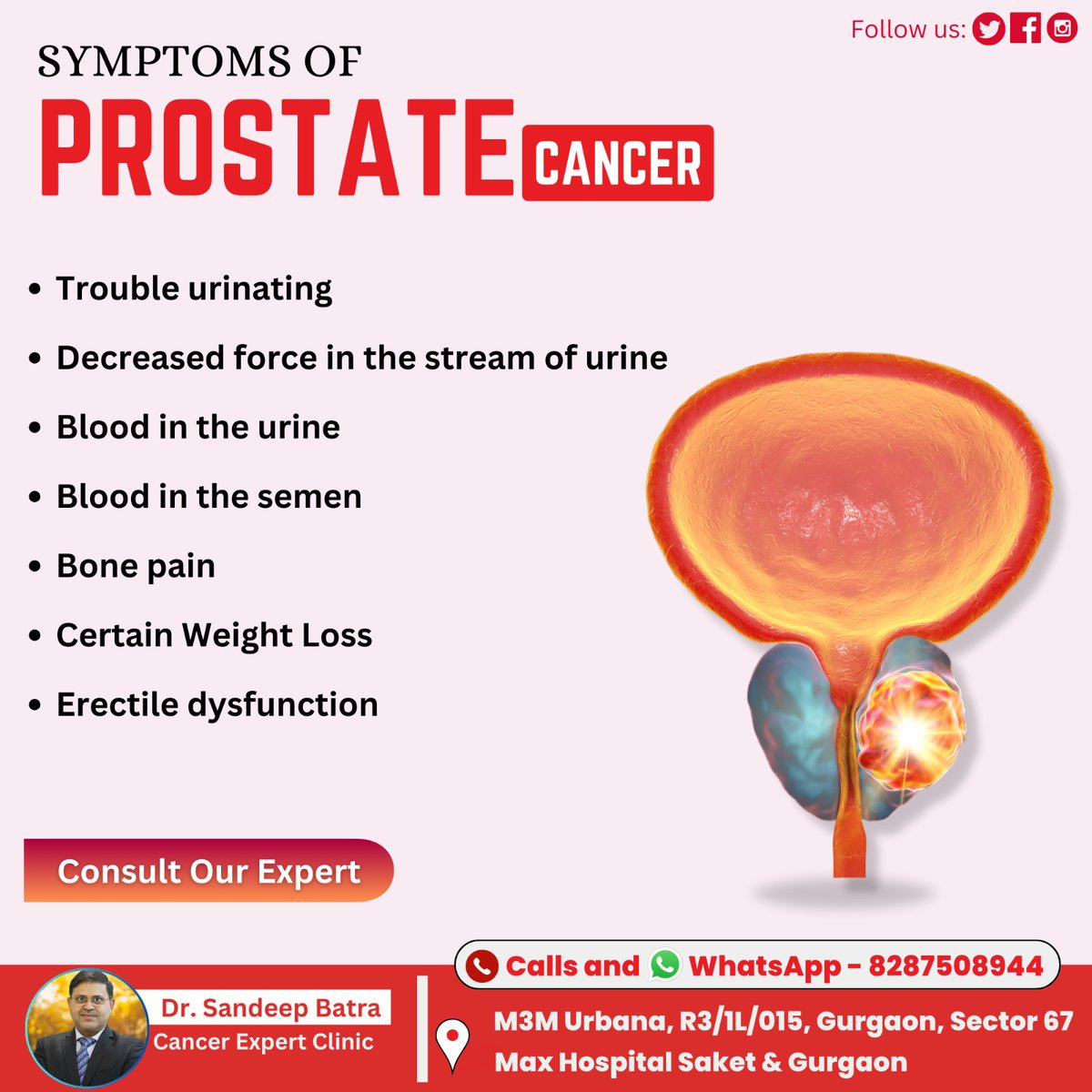 Symptoms of Prostate Cancer:

👨‍⚕️Dr. Sandeep Batra
Consultant:- Cancer Expert
Contact us at 📲8287508944
Visit us 📍M3M Urbana, R3/1L/015, Gurgaon, Sector 67 Max Hospital Saket &amp; Gurgaon

#Drsandeepbatra #Cancerexpert #cancersupport #cancerprevention #health #prostatecancer