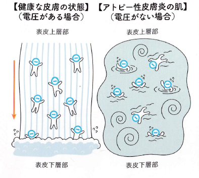 wishingwell2021's tweet photo. 電磁波アトピー性皮膚炎のメカニズム

アトピー性皮膚炎が電磁波でおこる代表的な病気であることは以前もポストしましたが、ではどのようなメカニズムで起こっているのでしょうか？

東日本大震災後の停電が続いた時に、アトピー性皮膚炎の通院患者さんが治ってしまったという丸山先生の逸話を紹介しましたが、電気がこの病気には密接に関係しています。

人体には常に生体電流が流れており、皮膚にも当然流れてます。丸山先生によると、皮膚上層部と下層部では電圧が違い、上層が高く下層が低くなっており、その方向にながれる電流が人工電磁波により圧が狂うと流れが止まり、いろんな皮膚症状が出るということです。

上記のことは大体の皮膚科のクリニックではまとめて原因不明ということになります。

一般的に冬は乾燥するので、皮膚のバリア機能が低下して悪化するので、ステロイド性の外用薬と保湿剤をしっかり塗って保湿するようにと言われているようです。

電磁波の面から考えると、上層と下層の間に静電気が溜まり、反発して皮膚がめくれるような症状がでるというふうに説明ができます。

原因を見つけないと一生お薬を塗り続けることになります。ステロイド軟膏などずっと塗っていると他の感染性の皮膚炎にもかかり安くなり皮膚科から本当に卒業できなくなります。

こういった場合、自宅か職場のどちらかに強力な電磁波を浴びる場所があり、それが原因のことが多いのです。

①電気カーペット使ってませんか？⇒使用をやめる

②ベッドや寝床の電場が高くなってませんか？⇒電気製品を遠ざける　場所を変える　アースを取る

③机周りの電場が高くなってませんか？⇒アースを取る　場所を変える

④アース取ってないPCで仕事してませんか？⇒アースを取る　充電で使用する

⑤Wi-Fiルーターが生活の場にありませんか？⇒出力を弱める　寝る時に切る　使用をやめる

見当がつかない場合は、電磁波測定士に依頼して調べてもらうこともお勧めします。

生活に電気や電波は必要ですが、特に交流電源（AC）は電磁波を伴い使用方法により体に害をもたらすことは、本来義務教育中に教えることだと思ってます。