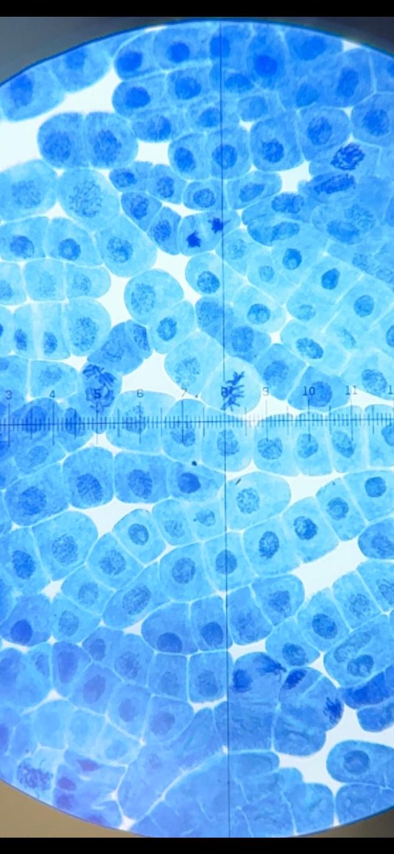 St Wilfrids Science (@stw_science) on Twitter photo Dr Larrington's <a href="/SWSixthForm/">St Wilfrids 6th Form</a> class.
Cells can be seen in the various stages of mitosis, metaphase, anaphase and telophase #Biology Dr Larrington's <a href="/SWSixthForm/">St Wilfrids 6th Form</a> class.
Cells can be seen in the various stages of mitosis, metaphase, anaphase and telophase #Biology