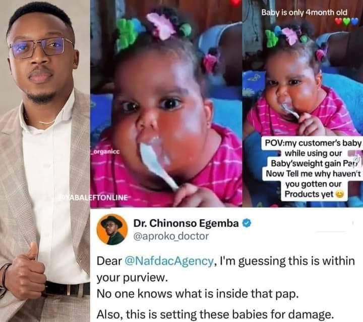MckezSol's tweet photo. Sometimes I wonder why parents especially mothers think that a Fat baby means a healthy baby. 

Child obesity is real
Thank you @aproko_doctor for this. @NafdacAgency I hope you have done something about this https://t.co/zMuK7h5IpR