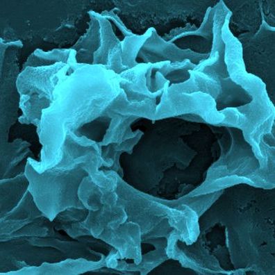 RMS (@royalmicrosoc) on Twitter photo Don't miss our ever-popular Electron Microscopy Spring School 2025!
Great course delivering basic training in both the theory and practice of scanning electron microscopy (SEM) and transmission electron microscopy (TEM) ๐ฌ๐
Book now: ow.ly/SGsZ50UeKwC
<a href="/RMS_EarlyCareer/">RMS Early Career Researchers</a> Don't miss our ever-popular Electron Microscopy Spring School 2025!
Great course delivering basic training in both the theory and practice of scanning electron microscopy (SEM) and transmission electron microscopy (TEM) ๐ฌ๐
Book now: ow.ly/SGsZ50UeKwC
<a href="/RMS_EarlyCareer/">RMS Early Career Researchers</a>