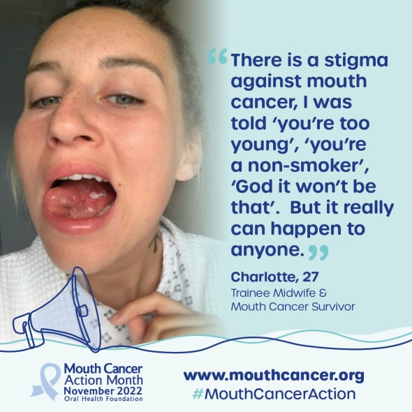 It is Mouth Cancer Action Month!

Charlotte Webster-Salter, 27, started getting recurring mouth ulcers in 2018, but thought she was feeling ‘run down' due to stress and her long shifts working as a flight attendant.  See here story: bit.ly/3A0XhRP 
#MouthCancerAction