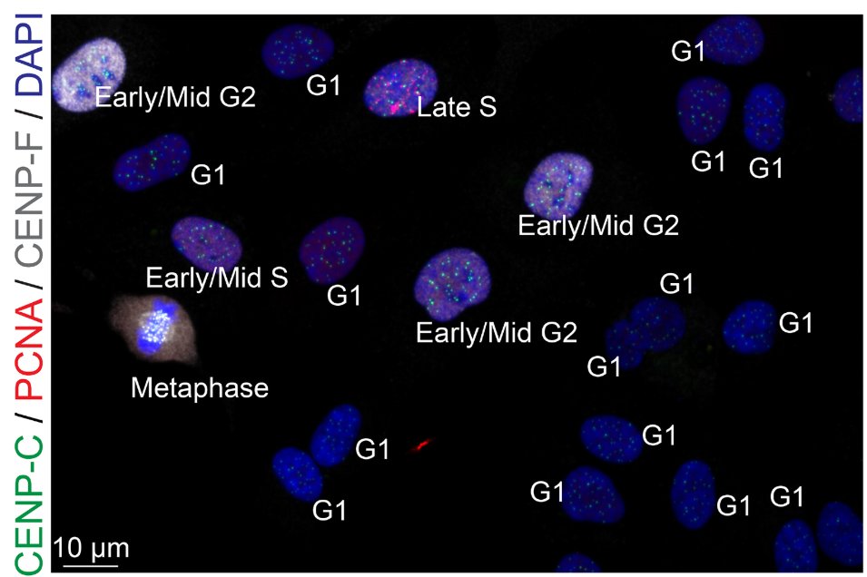 J Cell Science (@j_cell_sci) on Twitter photo Yu-Lin Chen, Yu-Chia Chen and <a href="/AussieSuzuki/">Aussie Suzuki</a> <a href="/UWMadison/">UW–Madison</a> <a href="/McArdleLab/">McArdle Laboratory</a> present ImmunoCellCycle-ID, a high-precision immunofluorescence-based method for cell cycle identification.
Highlight: journals.biologists.com/jcs/article/13…
Article: journals.biologists.com/jcs/article/13… Yu-Lin Chen, Yu-Chia Chen and <a href="/AussieSuzuki/">Aussie Suzuki</a> <a href="/UWMadison/">UW–Madison</a> <a href="/McArdleLab/">McArdle Laboratory</a> present ImmunoCellCycle-ID, a high-precision immunofluorescence-based method for cell cycle identification.
Highlight: journals.biologists.com/jcs/article/13…
Article: journals.biologists.com/jcs/article/13…