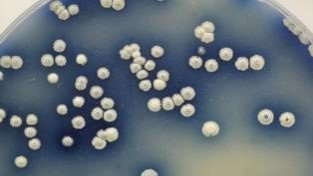 PCMFogg's tweet image. Collaborative and interdisciplinary @BBSRC #PhDposition now available @UniOfYork - tinyurl.com/3ve22fx7. Experience a vibrant mix of genetic and protein engineering, microbiology of an industrially relevant model organism, and single-molecule biophysics. Apply by 6th Jan.