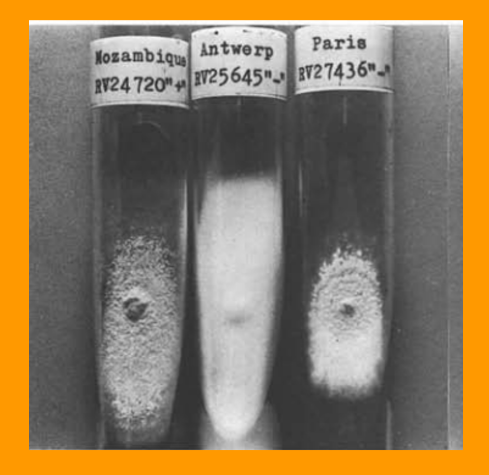 BCCM Collections (@bccmcollections) on Twitter photo Arthroderma vanbreuseghemii sp. nov. 
In honor of Prof. Vanbreuseghem for his great contribution to medical mycology. He's the founder of the RV collection initiated in Paris (1947), developed <a href="/ITMantwerp/">Institute of Tropical Medicine Antwerp</a> & transferred to BCCM/IHEM (1997)
IHEM 3299
#fungi #microbiology <a href="/belspo/">Belspo</a> Arthroderma vanbreuseghemii sp. nov. 
In honor of Prof. Vanbreuseghem for his great contribution to medical mycology. He's the founder of the RV collection initiated in Paris (1947), developed <a href="/ITMantwerp/">Institute of Tropical Medicine Antwerp</a> & transferred to BCCM/IHEM (1997)
IHEM 3299
#fungi #microbiology <a href="/belspo/">Belspo</a>