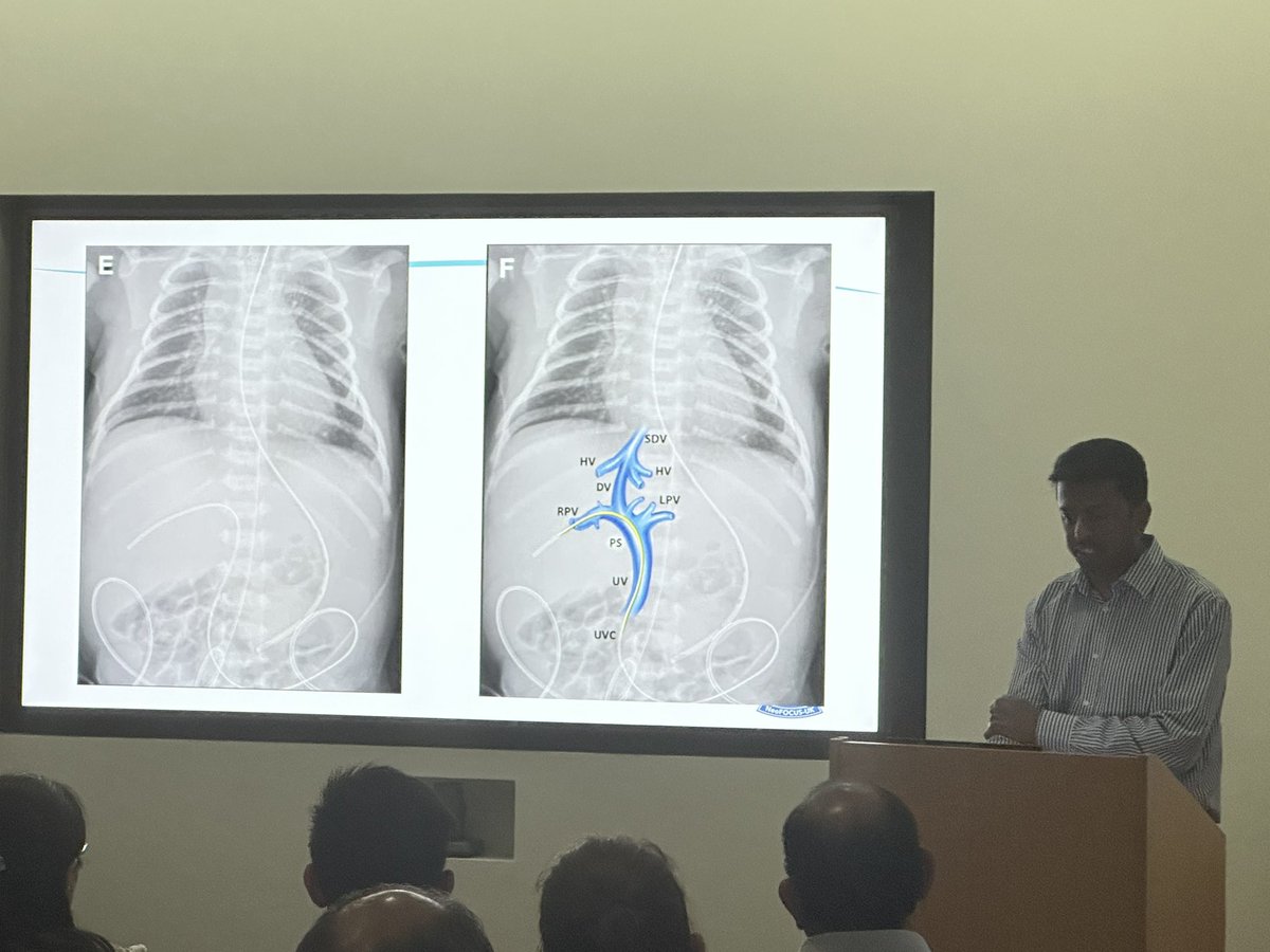 dr_montasser's tweet photo. Our #Neonatal_POCUS workshop in @NeonatalUpdate conference!
Thanks to my colleagues @JayBanerjeeNeo  @DrHarshaGowda and @anna_milan for your time. Thanks @NeonatalUpdate for the invitation! Thanks @GE_IanMc for your support! https://t.co/FDsM91HNB9