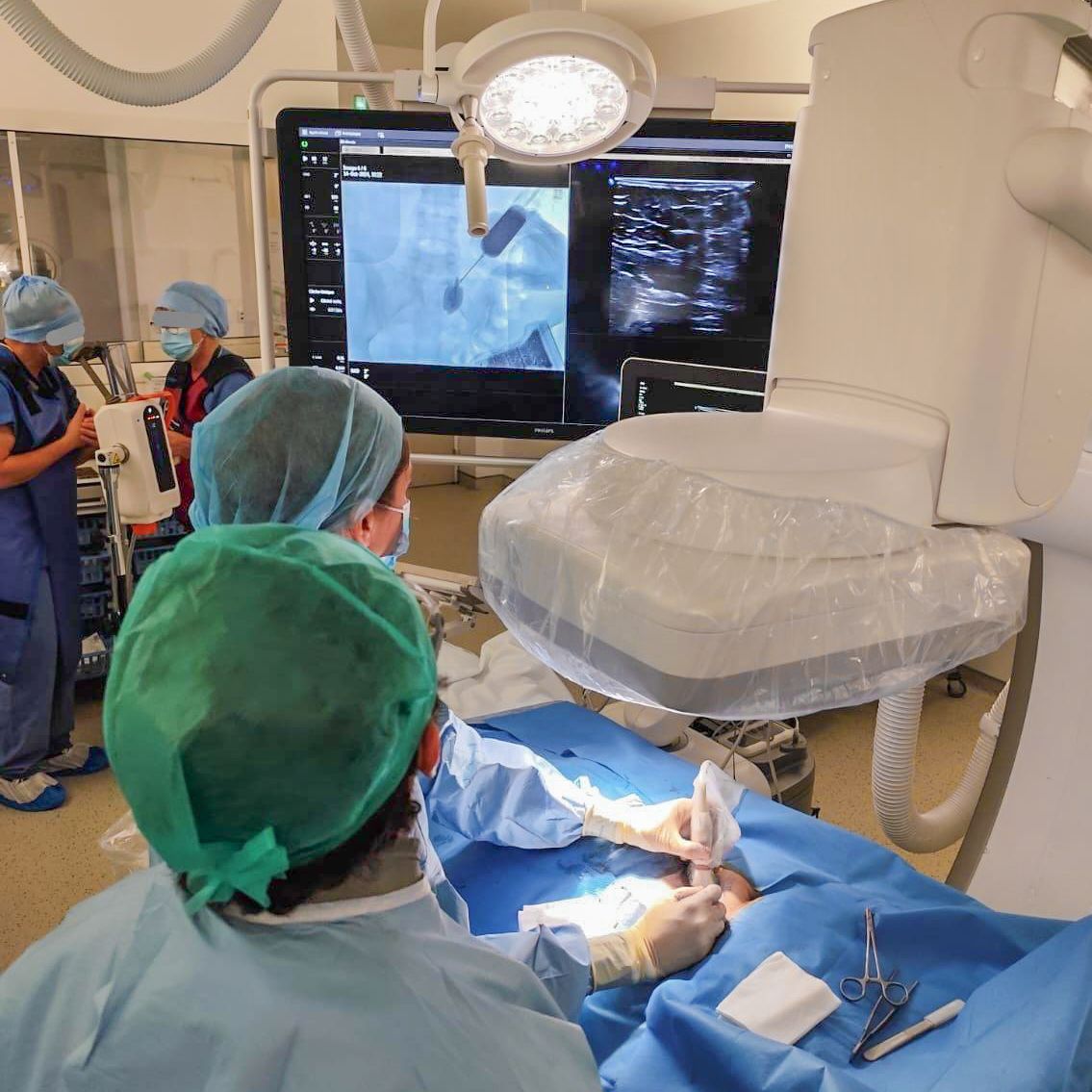 💡 Vent nouveau sur les cathéters de dialyse péritonéale ! ⭐

🕰️ Historiquement réalisée sous anesthésie générale par un chirurgien, la pose de cathéter de dialyse péritonéale peut également être effectuée par un médecin néphrologue, par voie percutanée.