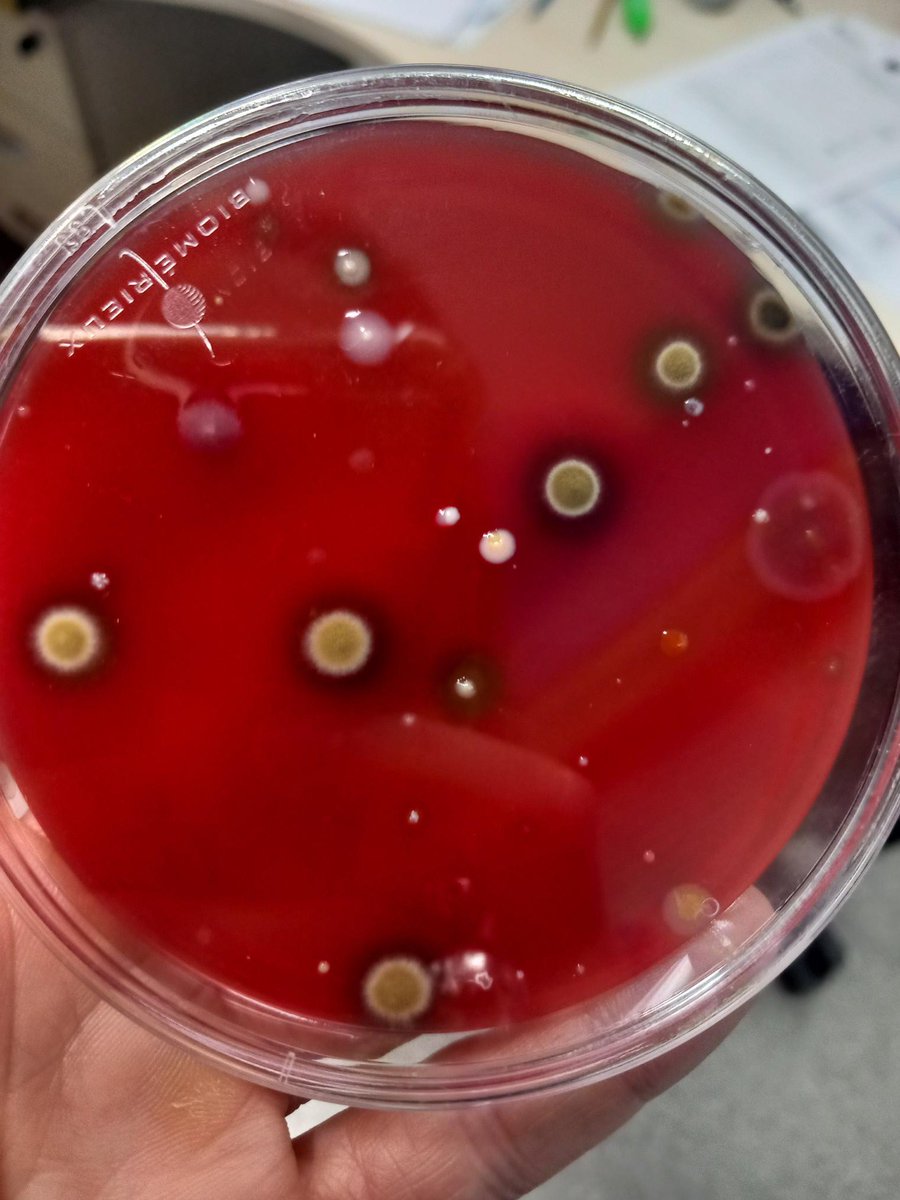 🌿¡¡Aunque el curso de BIOARTE ha terminado, nuestras creaciones siguen vivas¡¡ 🌈✨Gracias Juan Zamora por inspirarnos en estas obras poéticas que continúan evolucionando 🤩#FormacionCyL #InnovaCyL #BIOARTE <a href="/CFIE_Segovia/">CFIE de Segovia</a> <a href="/CSFPJCYL/">CSFP</a>