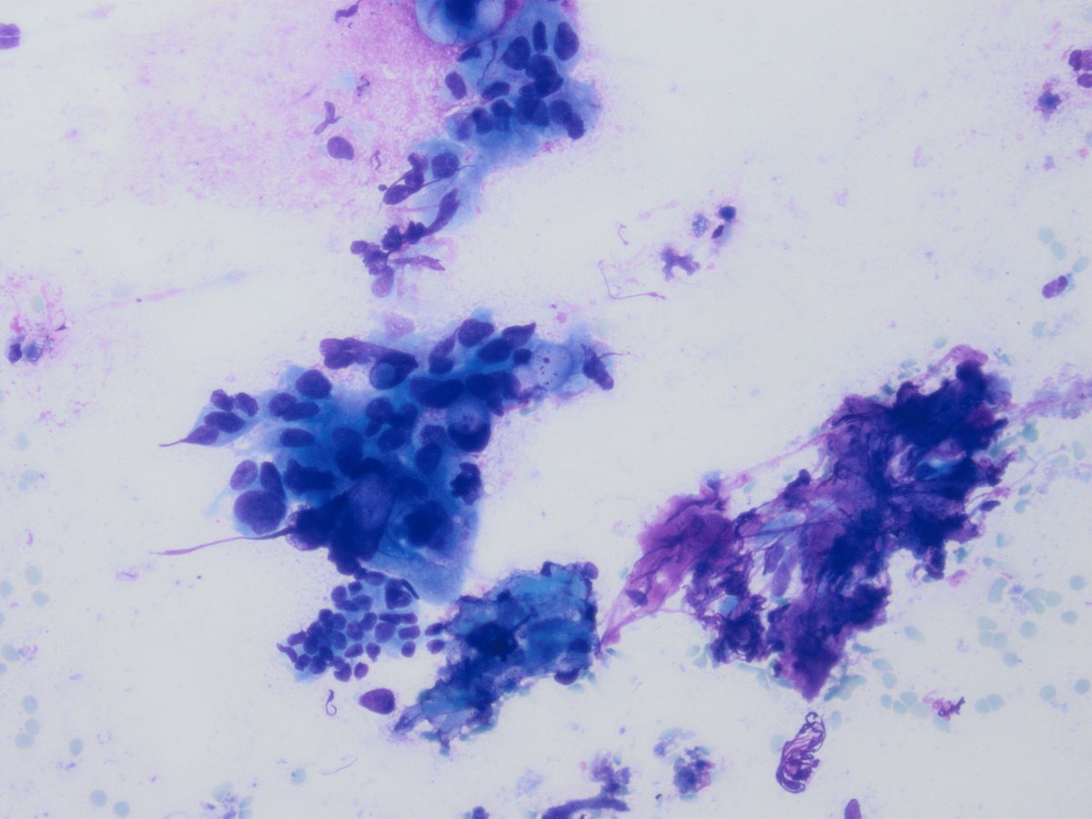 UAB Pathology tweet media