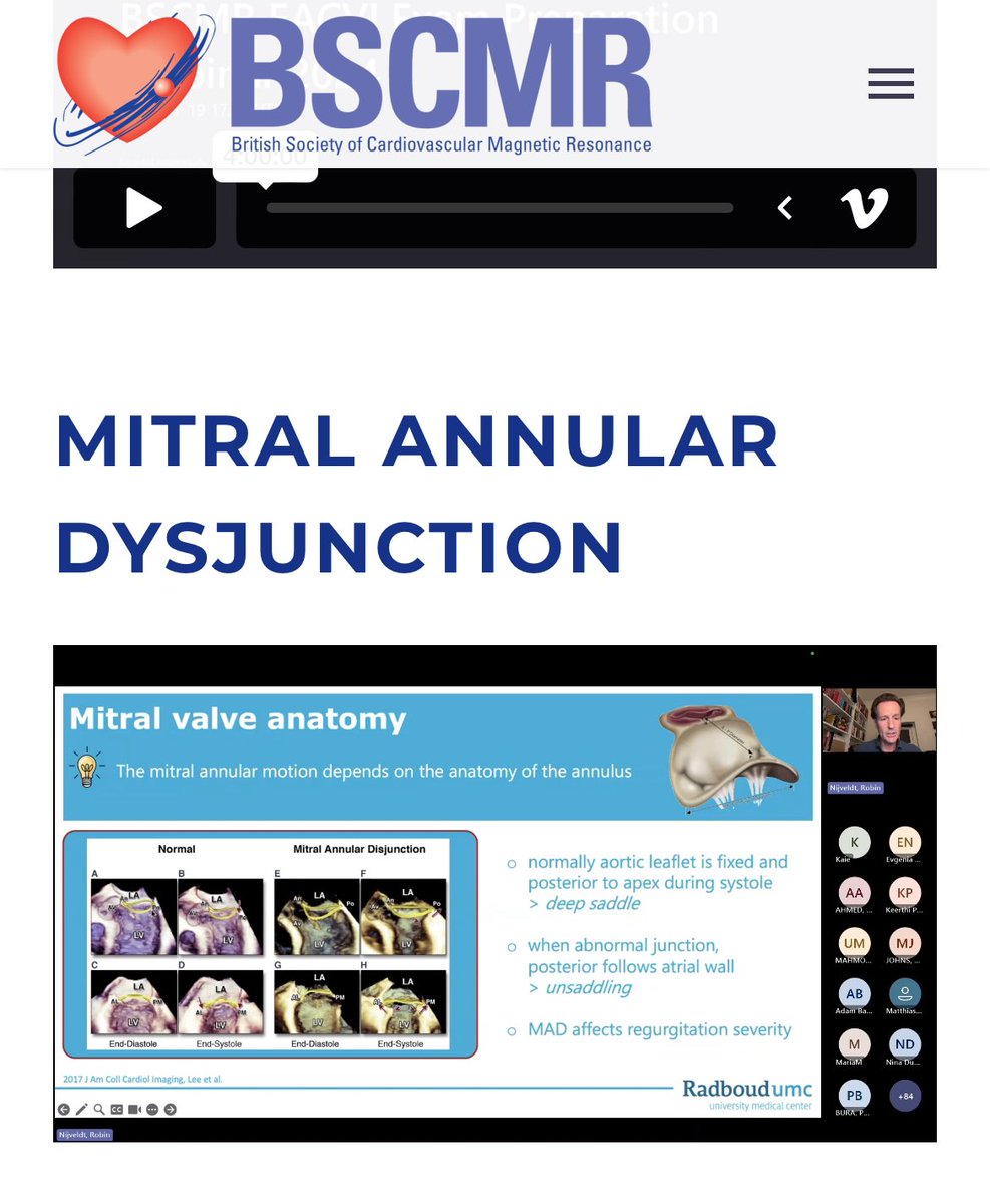Fear not <a href="/BSCMR/">BSCMR</a> members! 😱❌

If you missed the live screening of the hugely interesting MAD webinar by <a href="/RNijveldt/">Robin Nijveldt</a> you can access this now 
via our website. 

Click here  ⬇️ 
tinyurl.com/36hafrfy