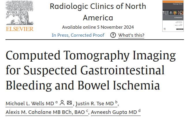 SAR GI Bleeding DFP (@sar_gibleeddfp) on Twitter photo Recently published review of CT for suspected GI bleeding by DFP members Drs. Wells, Tse, Cahalane, and Gupta <a href="/mkma03gi/">Michael Wells</a> <a href="/JustinTseMDRad/">JustinTseMDRadiology</a> Recently published review of CT for suspected GI bleeding by DFP members Drs. Wells, Tse, Cahalane, and Gupta <a href="/mkma03gi/">Michael Wells</a> <a href="/JustinTseMDRad/">JustinTseMDRadiology</a>
