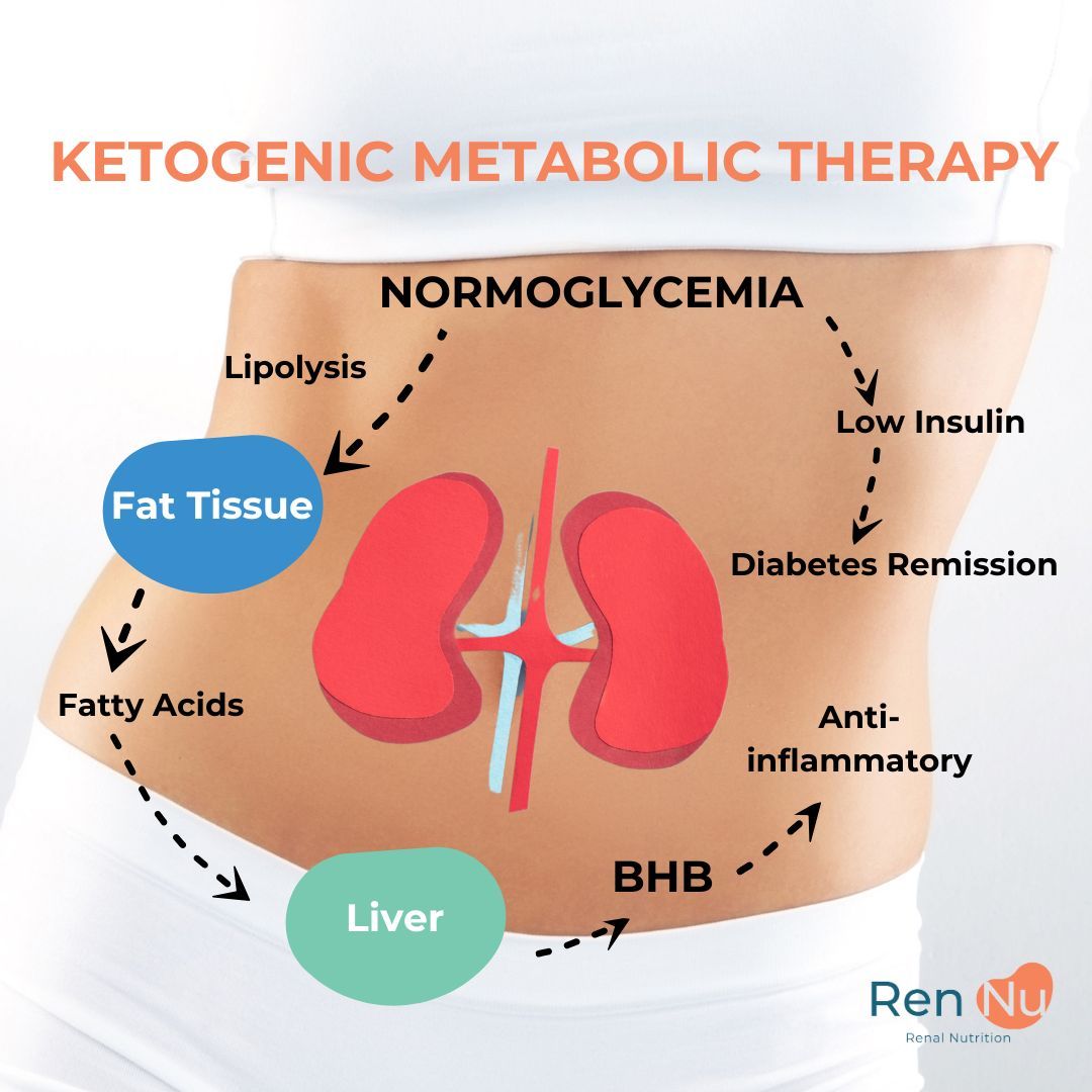 SBNutrients's tweet image. Did you know maintaining normoglycemia (stable blood sugar levels) is crucial in managing Polycystic Kidney Disease (PKD)? This study highlights how Ketogenic Metabolic Therapy (KMT) can improve kidney health by reducing insulin resistance and promoting metabolic balance.
👉…
