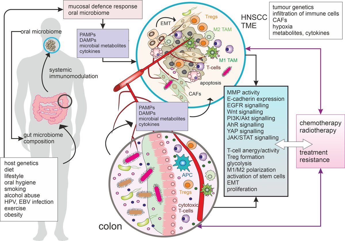 Michal Masarik (@biochemik2204) on Twitter photo 📢 Our new review in BBA Rev Can @BBAjournals describing the interrelationship between host, microbiome🦠, carcinogenesis 🦀, and cancer therapy is online now.Thanks to all.
<a href="/Science_MEDMUNI/">Science @ MED MUNI</a> <a href="/1LFUK1/">1. lékařská fakulta Univerzity Karlovy</a> <a href="/DavidKalfert/">David Kalfert</a> <a href="/FnMotol/">Fakultní nemocnice v Motole</a> <a href="/masariklab/">Masarik Cancer Research Lab</a> <a href="/NaBulovce/">Fakultní nemocnice Bulovka</a> <a href="/FNUSA_ICRC/">International Clinical Research Center</a>
sciencedirect.com/science/articl… 📢 Our new review in BBA Rev Can @BBAjournals describing the interrelationship between host, microbiome🦠, carcinogenesis 🦀, and cancer therapy is online now.Thanks to all.
<a href="/Science_MEDMUNI/">Science @ MED MUNI</a> <a href="/1LFUK1/">1. lékařská fakulta Univerzity Karlovy</a> <a href="/DavidKalfert/">David Kalfert</a> <a href="/FnMotol/">Fakultní nemocnice v Motole</a> <a href="/masariklab/">Masarik Cancer Research Lab</a> <a href="/NaBulovce/">Fakultní nemocnice Bulovka</a> <a href="/FNUSA_ICRC/">International Clinical Research Center</a>
sciencedirect.com/science/articl…