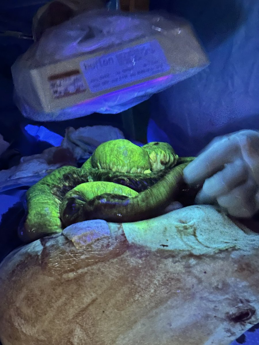 Avery Walker, MD, FACS, FASCRS tweet media