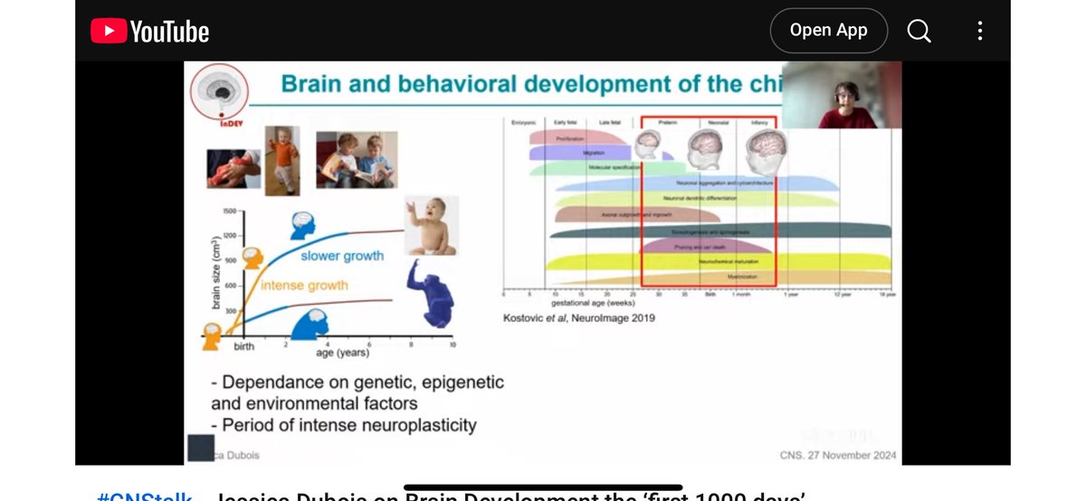 CNSeminars's tweet image. Live now on YouTube. The first 1000 days of development. Jump in and join the discussion
m.youtube.com/watch?v=TqyGi4…