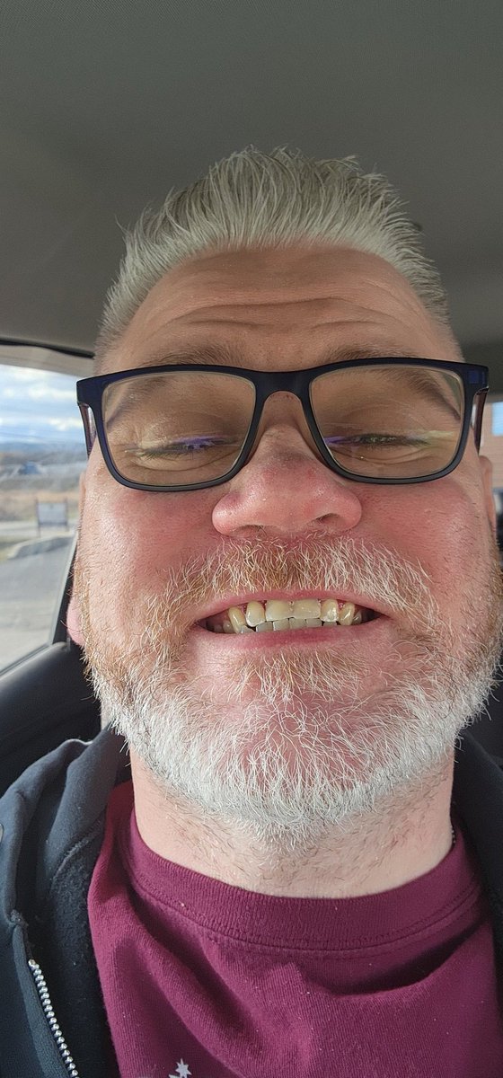 FatherNerdGamer's tweet image. Welp never had to say or do this as a kid but I'm getting my two front teeth for Christmas!!! Temp crowns till the 23rd.
#frontteeth #Xmas