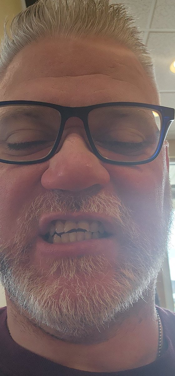 FatherNerdGamer's tweet image. Welp never had to say or do this as a kid but I'm getting my two front teeth for Christmas!!! Temp crowns till the 23rd.
#frontteeth #Xmas