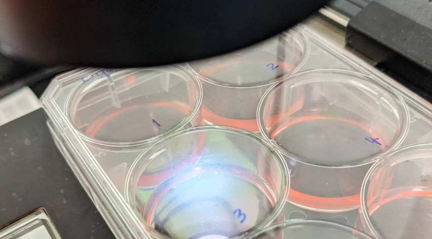 Mayo Clinic's Center for Regenerative Biotherapeutics is collaborating with the biotech firm <a href="/hepatx/">HepaTx</a> on an experimental therapy to regenerate tissue in patients with late-stage #liverdisease. <a href="/MayoClinic/">Mayo Clinic</a> 
mayocl.in/41itXBC