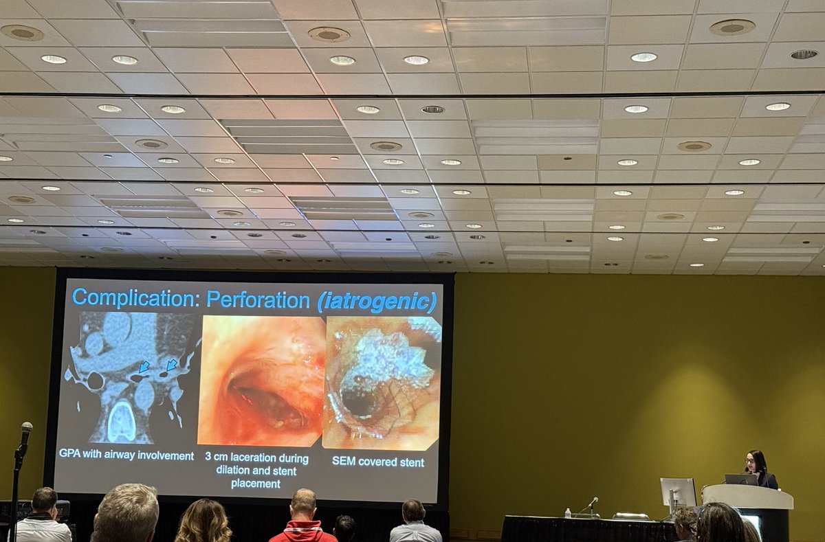 Lauren Kriger Groner (@laurengroner) on Twitter photo Excellent overview of intrathoracic medical devices you might encounter as a #radiologist 🩻 🫁🫀#RSNA24 <a href="/DanielVargasMD/">Daniel Vargas, MD</a> <a href="/DanielaMartinMD/">Maria Daniela Martin, M.D.</a> Excellent overview of intrathoracic medical devices you might encounter as a #radiologist 🩻 🫁🫀#RSNA24 <a href="/DanielVargasMD/">Daniel Vargas, MD</a> <a href="/DanielaMartinMD/">Maria Daniela Martin, M.D.</a>
