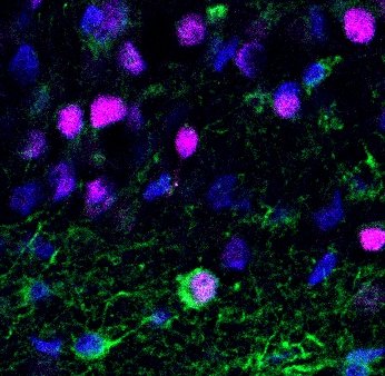 USC Stem Cell (@uscstemcell) on Twitter photo To remember conversations, keep making new brain cells. Led by USC's Michael Bonaguidi and Charles Liu, a study of patients with epilepsy shows how making new neurons benefits cognition in adults. <a href="/USCStemCell/">USC Stem Cell</a> <a href="/bonaguidilab/">Bonaguidi Lab</a> @KeckSchool_USC <a href="/CellPressNews/">Cell Press</a> stemcell.keck.usc.edu/to-remember-co… To remember conversations, keep making new brain cells. Led by USC's Michael Bonaguidi and Charles Liu, a study of patients with epilepsy shows how making new neurons benefits cognition in adults. <a href="/USCStemCell/">USC Stem Cell</a> <a href="/bonaguidilab/">Bonaguidi Lab</a> @KeckSchool_USC <a href="/CellPressNews/">Cell Press</a> stemcell.keck.usc.edu/to-remember-co…