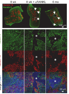 Waggoner Lab (@labwaggoner) on Twitter photo RANK ligand administration reversed age-dependent thymic involution and rejuvenated T cell immunity in mice <a href="/ScienceTM/">Science Translational Medicine</a>
science.org/doi/10.1126/sc… RANK ligand administration reversed age-dependent thymic involution and rejuvenated T cell immunity in mice <a href="/ScienceTM/">Science Translational Medicine</a>
science.org/doi/10.1126/sc…