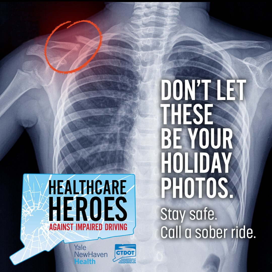 ynhhealth's tweet photo. This Thanksgiving let’s focus on making memories—not on injuries. Don’t let X-rays be the highlight of your holiday photos. Yale New Haven Health and #CTNotOneMore encourage you to plan for a sober ride home and stay safe. https://t.co/9TylYe6IVZ