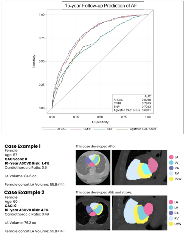 ⚕️🫀 "Coronary Artery Calcium Scans Powered by Artificial Intelligence (AI-CAC) Predicts Atrial Fibrillation and Stroke Comparably to Cardiac Magnetic Resonance Imaging: The Multi-Ethnic Study of Atherosclerosis (MESA)"

"AI-CAC automated LA volumetry and CMRI LA volume measured