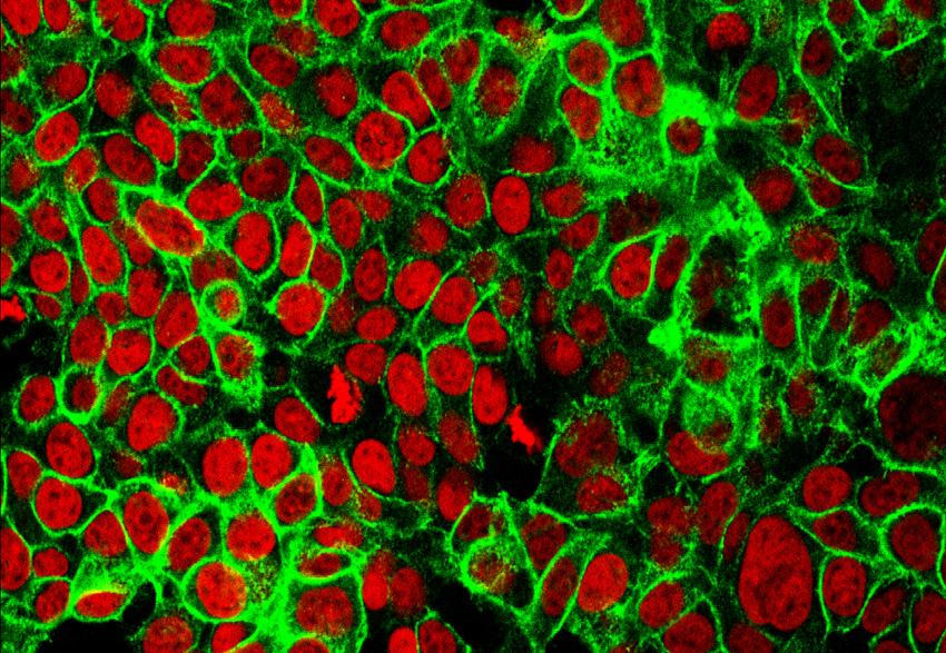 Infosalut (@infosalut) on Twitter photo #PublicaSalutIB Protocolo observacional para reconstrucción 3D en planificación quirúrgica del #cáncerdecolon avanzado <a href="/SonEspases/">HU Son Espases</a> <a href="/idisbaib/">IdISBa</a> <a href="/SebJeri21/">Sebastián Jerí-McFarlane</a> <a href="/sobacir/">SOBACIR</a> i.mtrbio.com/tvkkzltmtz i.mtrbio.com/rvrryegycx #PublicaSalutIB Protocolo observacional para reconstrucción 3D en planificación quirúrgica del #cáncerdecolon avanzado <a href="/SonEspases/">HU Son Espases</a> <a href="/idisbaib/">IdISBa</a> <a href="/SebJeri21/">Sebastián Jerí-McFarlane</a> <a href="/sobacir/">SOBACIR</a> i.mtrbio.com/tvkkzltmtz i.mtrbio.com/rvrryegycx