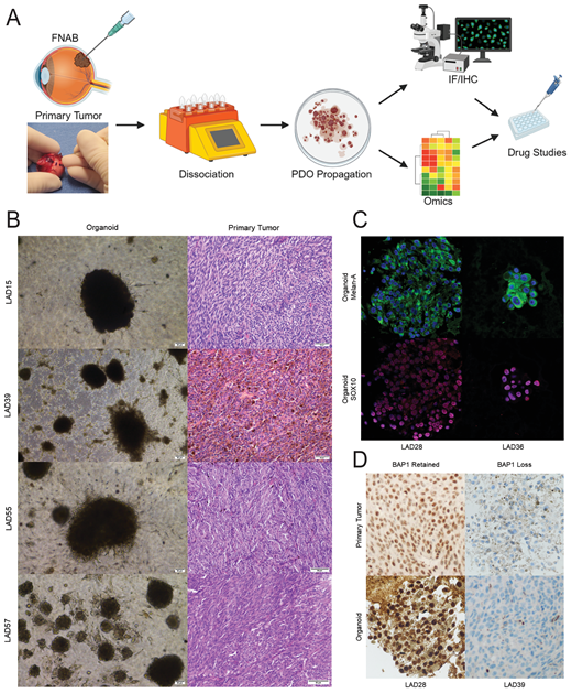 IOVS Journal (@arvoiovs) on Twitter photo Lauren A. Dalvin <a href="/LADalvinMD/">Lauren A. Dalvin, MD</a> et al. <a href="/MayoClinicEye/">Mayo Clinic Department of Ophthalmology</a> developed and characterize a multicenter biobank of uveal melanoma patient-derived organoids.
doi.org/10.1167/iovs.6… Lauren A. Dalvin <a href="/LADalvinMD/">Lauren A. Dalvin, MD</a> et al. <a href="/MayoClinicEye/">Mayo Clinic Department of Ophthalmology</a> developed and characterize a multicenter biobank of uveal melanoma patient-derived organoids.
doi.org/10.1167/iovs.6…