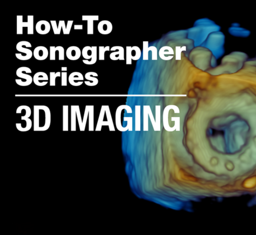 🫀 NEW PRODUCT 🫀
Our "How-To Sonographer Series: 3D Imaging" online course provides practical hands-on instruction for acquisition of high quality of 3D images for evaluation of the tricuspid valve and mitral valve.

Learn more and sign up today: bit.ly/3AYXR3e