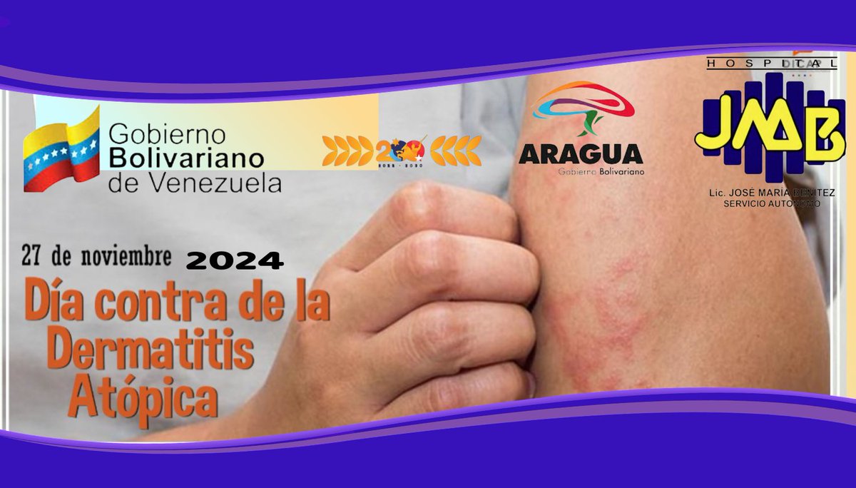#27DeNoviembre Es la enfermedad cutánea más frecuente en la infancia, suponiendo el 60% de los casos de dermatitis atópica diagnosticados. <a href="/DraShirleySalud/">Dra. Shirley Hernández</a> <a href="/asic_santa/">ASIC SANTA ANA</a> <a href="/AlcDeGirardot/">Alcaldía de Girardot</a> <a href="/FNJPetrolera/">Juventud Petrolera, Gasífera y Petroquímica</a> <a href="/pozenlinea/">juventudvenezuela</a> <a href="/DraMaribelNunez/">Cuenta Respaldo SADHCM</a> <a href="/Hcmsalud/">Servicio Autónomo Hospital Central de Maracay</a> <a href="/Soykarinacarpio/">Karina Carpio</a> <a href="/ALEXANDERSOLOR3/">El Comunicador Alternativo Nacional</a>
