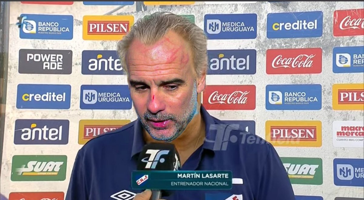 Que le pasó a Lasarte en la cara?