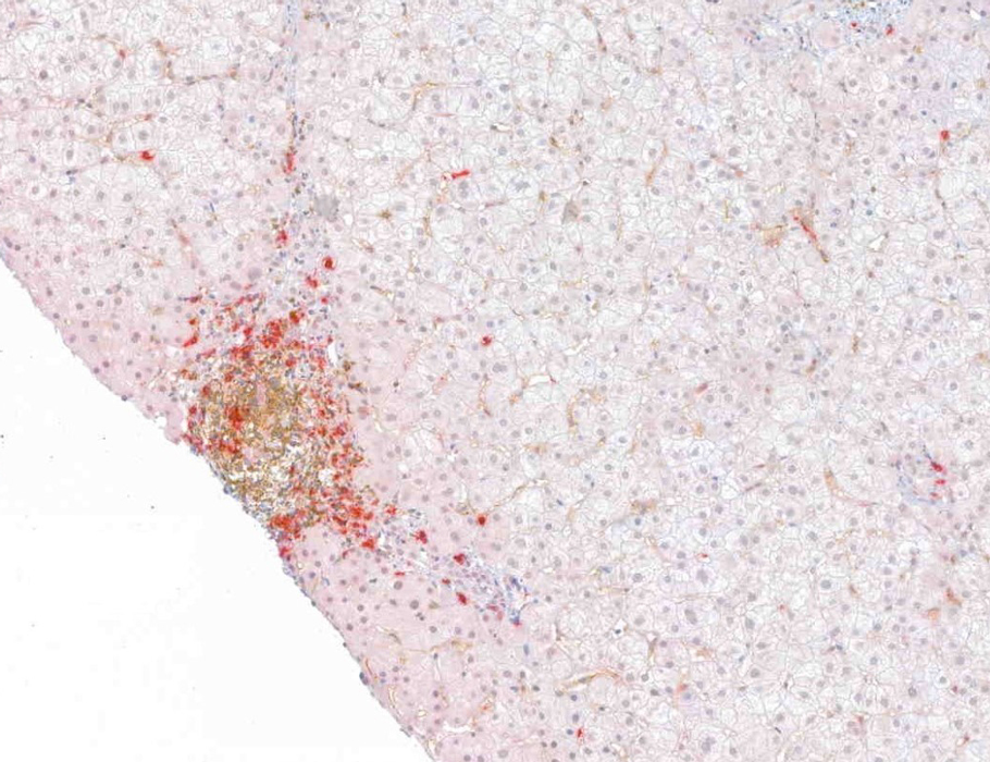 New research suggests that mutations in #LTBR underlie an inborn error of immunity and lead to defects in secondary lymphoid organ development in humans. 

Read more in <a href="/SciImmunology/">Science Immunology</a>: bit.ly/4eUMF5K