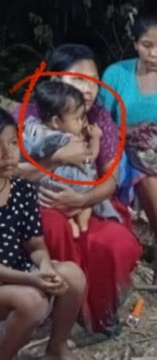 TheBlueHills49's tweet photo. 🆘🆘🆘 This is how a 8 month old baby was tortured to death by the so-called  #KukiMartyrs 🆘🆘🆘

‼️The most horrific and inhumane crime a 8 month old baby would have ever have to go through in history ‼️

1. 😩The #KukiMartyrs used enough Brutal force on the baby to  pulled out/ hack/gouged both the eyes. 
Was it with bare hands or with a knife ? 

2. 😩Venomous  Blows to the baby face with stick or rifle gun butt causing Massive bruising  that covered almost all the child’s face with distortion of the baby’s eyes, cheeks and nose

3. 😩The #KukiMartyrs punched or hit the baby’s face so hard with Brute blunt, causing Massive gaping wound that would cover the whole of the child chin ( 21 cm length and 6 cm breath) where chin bone can be even seen. 
Who could hit  the innocent baby face hit so hard that even the bone can be seen 

4. 😩The #KukiMartyrs hit the baby shoulder so hard that the baby shoulder  dislocated and broken. What kind of people can used such amount of violence 

5. 😩Not enough the #KukiMartyrs used a large knife or an axe to hit the baby chest causing a Large chop wound  of 7 cm length , that broke the fragile ribs 🩻 and middle  chest bones that was so deep it cuts into the baby’s lungs 🫁 

6. 😩Then the #KukiMartyrs, hit the baby with a weapon so hard that there was a large wound in the flank which exposed the hip bone.

7. 😩The baby must be crying so much due to all the pain with all these brutal force and torture only to be shot  with a gun where the bullet went through to his left knee 

8. 😩Then the #KukiMartyrs use a knife to cut into the 8 month old baby stomach where the poor baby muscles were cut through .

‼️This is the #Kuki_Zo story of how they tortured , butchered and performed most inhumane #KukiAtrocities on just a 8 month old baby , the most innocent soul one could ever find .‼️

🆘Would his mother watched as her baby was tortured and shot to death 🆘

🔥This is #KukiTerrorism which many of the drug cartel funded media like the @ThePrintIndia @thewire_in , @EastMojo @DeccanHerald @SAsiaSolidarity @sangbarooahpish @vijaita @jeegujja @afridahussai @meipat are depicting this criminal as innocent tribal martyrs .🔥

@UNHumanRights @hrw @AbhijitChavda @MeghUpdates @TimesAlgebraIND @OpIndia_com @CNN @Reuters @AlJazeeraWorld