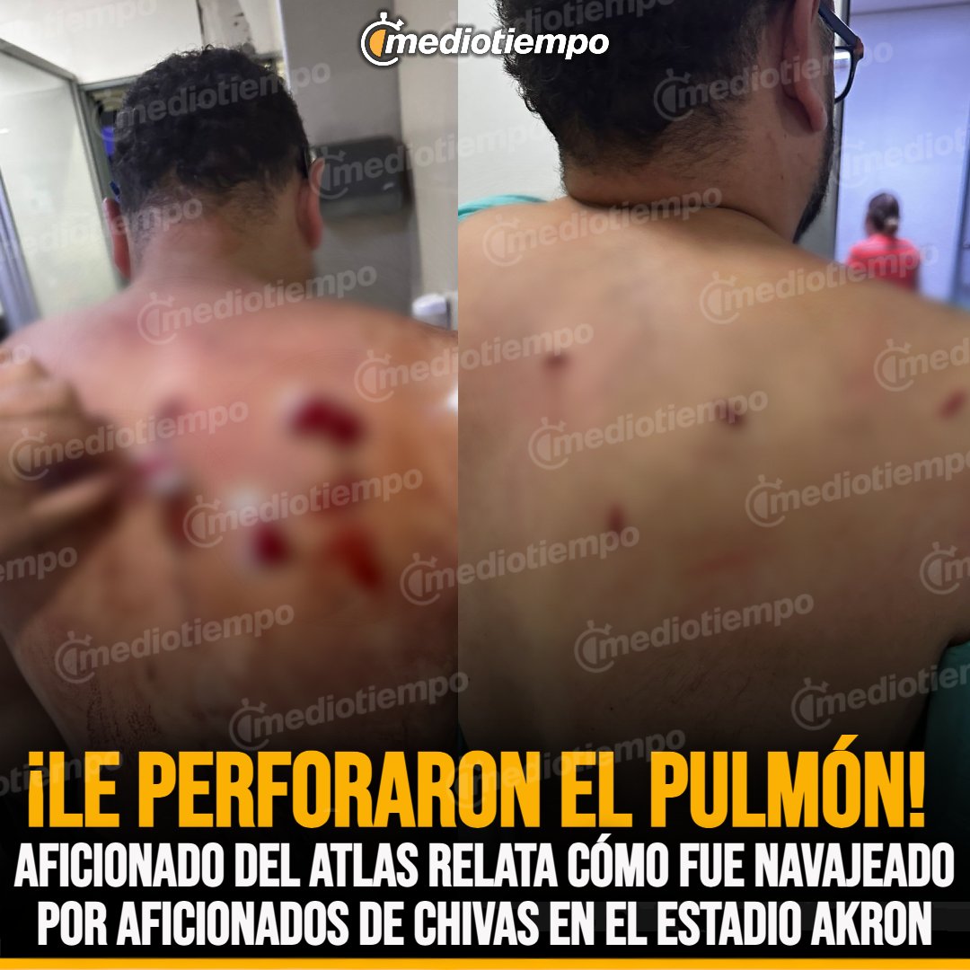 pieldezorrogdl's tweet image. Entonces NOE MORA de la calle 7 Colinas y Circunvalación ¿Es o no es quien acuchilló a Gerardo Soria?

@PoliciaGDL 
@FiscaliaJal 
@FMF 
@LigaBBVAMX 
@MikelArriolaP 
@Chivas
@FIFAcom
@fantasmasuarez 
@ArizpeMiguelZ 
@jmanuelfigueroa 
@josemagarrido 
@Betto_Avalos 
@estoenlinea