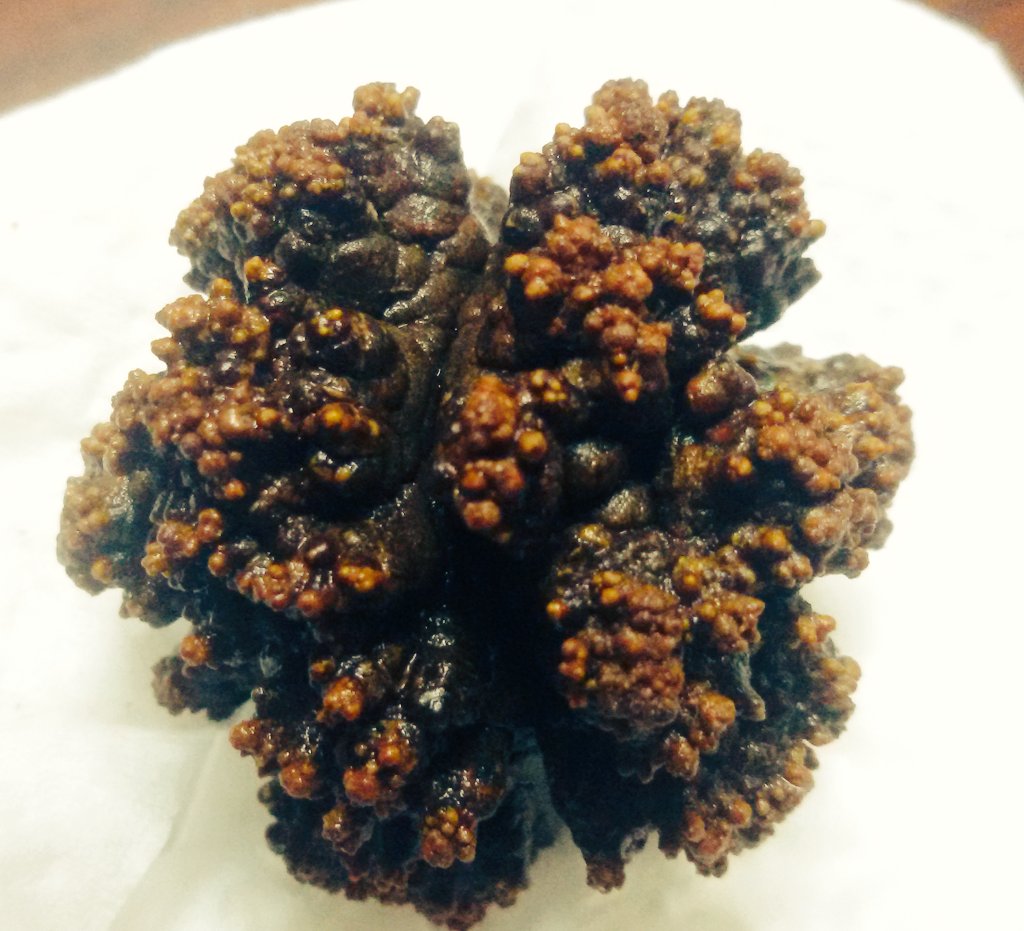 Calcium oxalate monohydrate stone.
حصوة اوكسالات الكالسيوم. 
تم استخراجها بفضل الله و توفيقه من مريض.