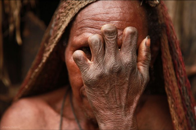 _kingjonah's tweet image. The most unique traditions around the world 

1. In Papua New Guinea, when someone dies, family members cut off their own fingers as a sign of mourning.