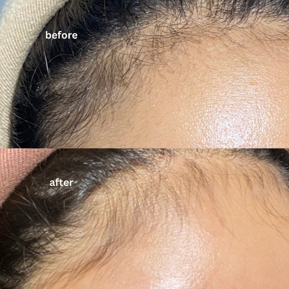 ucnicorn's tweet photo. sekarang udah ga takut sama yang namanya rontok, apalagi sejak pake haircare yang satu ini😍✨

yang bikin rambut rontok berkurang dan baby hairku jadi cepet panjang🤏🏻😋 https://t.co/tlCXpi2ltb