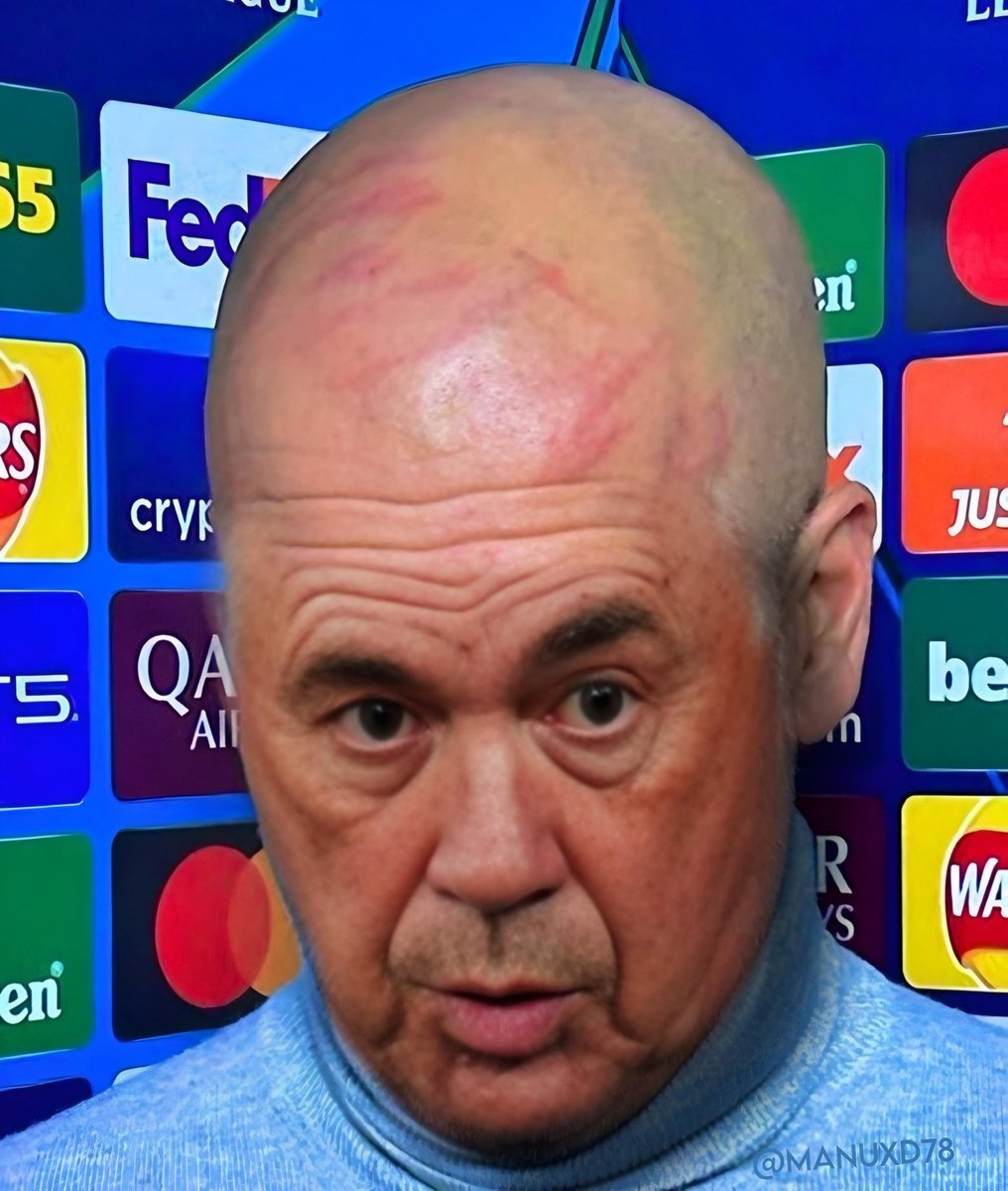 nocontextfooty's tweet photo. https://t.co/DtRgZRJOwA