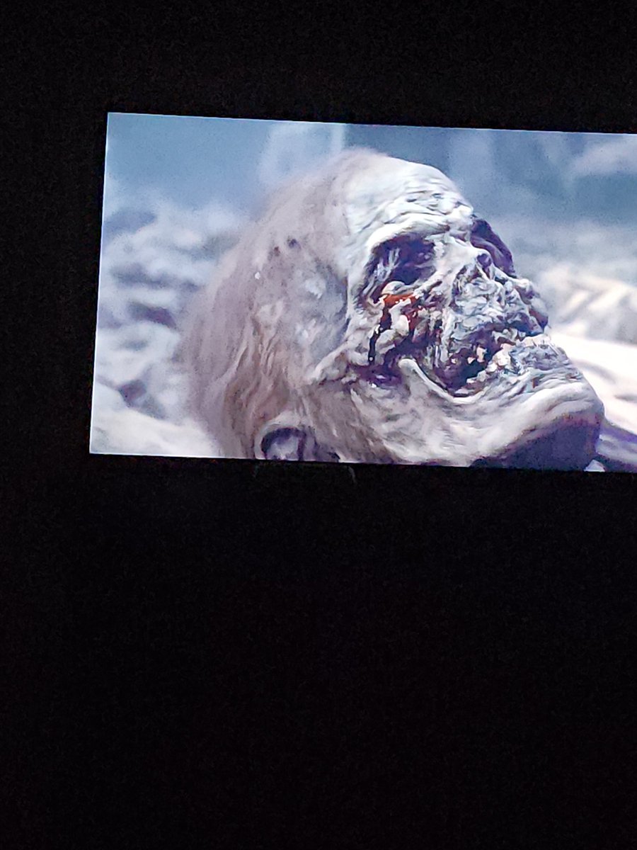 Curtisd572's tweet image. Me right now with my sinuses being assholes! #sinusproblems