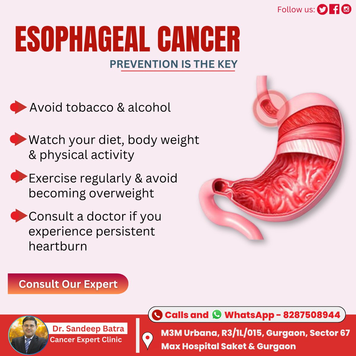 ESOPHAGEAL CANCER PREVENTION IS THE KEY

👨‍⚕️Dr. Sandeep Batra
Consultant:- Cancer Expert
Contact us at 📲8287508944
Visit us 📍M3M Urbana, R3/1L/015, Gurgaon, Sector 67 Max Hospital Saket &amp; Gurgaon

#esophagealcancer #esophagealcancerawareness #cancer #stomachcancer #esophagus