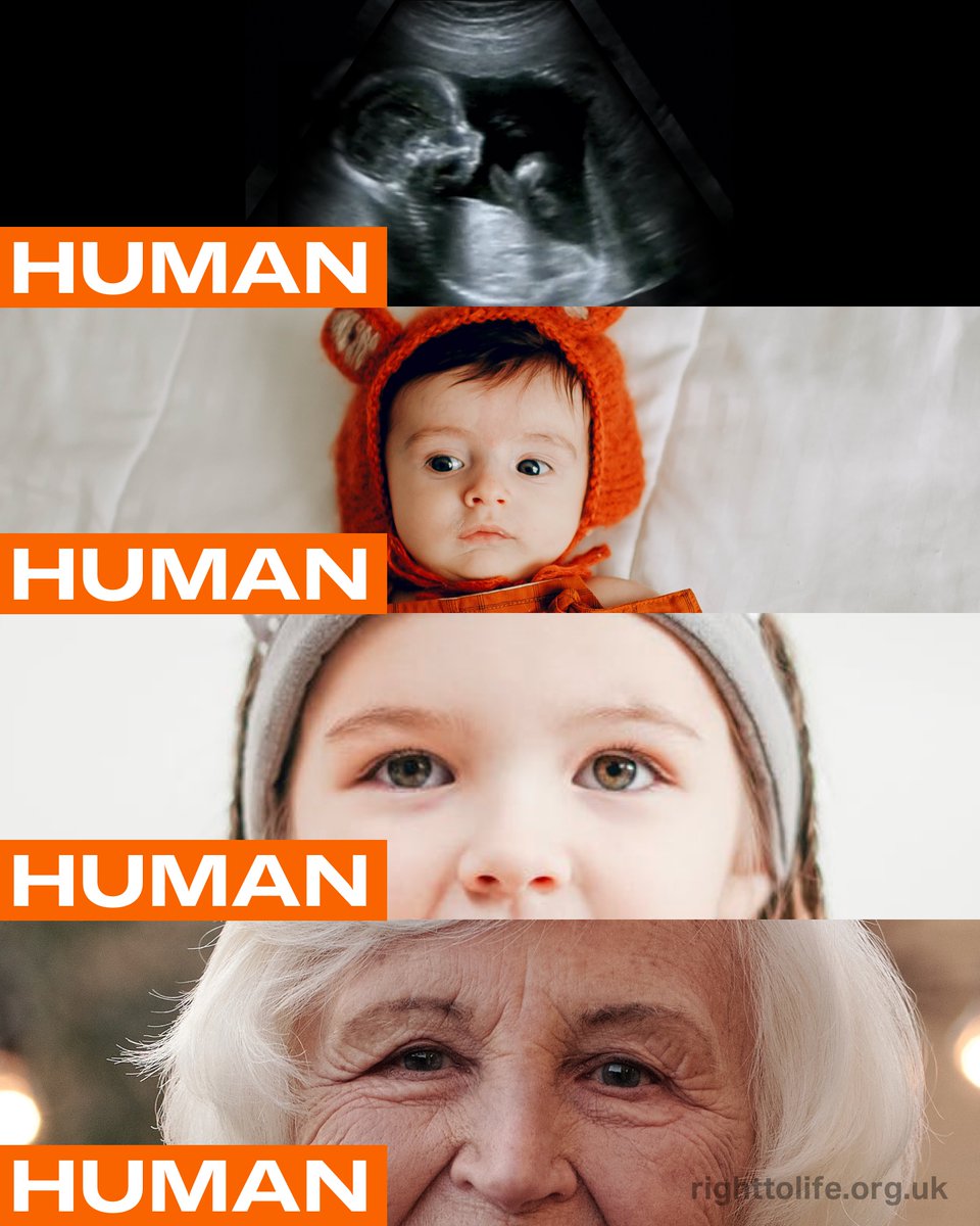 RightToLifeUK's tweet image. Always human 🤰👶 👧 👩
