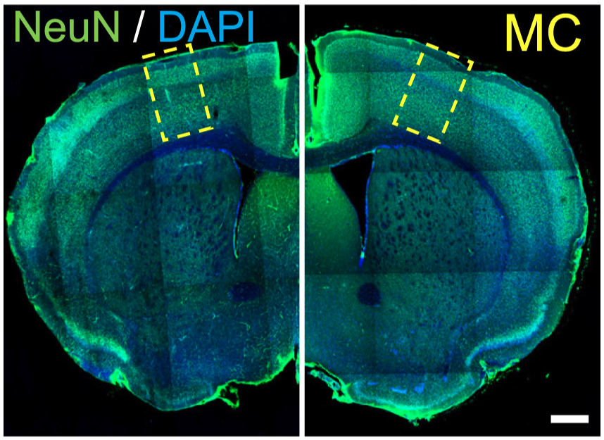 🧠Rejuvenate brain neurons through #CellularReprogramming: more neurons and more brain plasticity.

✍️A study co-authored by <a href="/Sofzaballa/">Sofía Zaballa</a> (<a href="/UniBarcelona/">Universitat de Barcelona</a>, <a href="/idibaps/">IDIBAPS</a>, @ciberned), with participation from #ManuelSerrano (#IRBBarcelona).

📰<a href="/CellStemCell/">Cell Stem Cell</a>

➡️tinyurl.com/nhkv7xbc