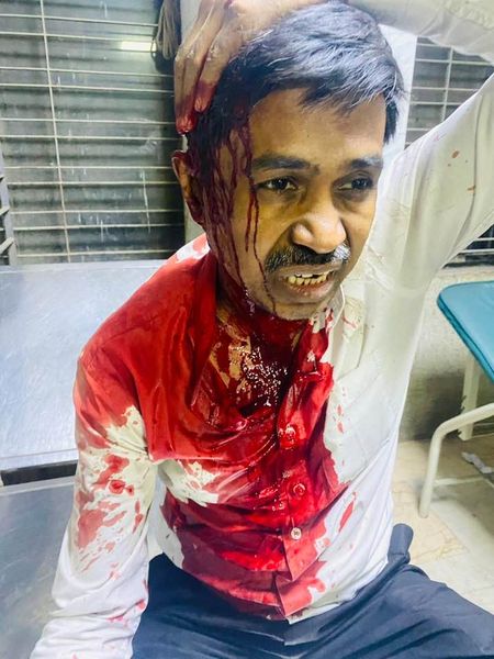 austhindu's tweet photo. Bangladeshi Hindu Supreme Court Advocate Ramendra Nath Roy is fighting for his life, after being brutally attacked on 25 November 2024 by an Islamist mob led by radicals Jamat Shibir and Hizbut Tahir. Roy had been part of a peaceful protest against the arrest of Hindu monk –Chinmoy Krishna Das. He has been on life support at Dhaka Lebed Hospital since the attack. #BangladeshiHindusInDanger
