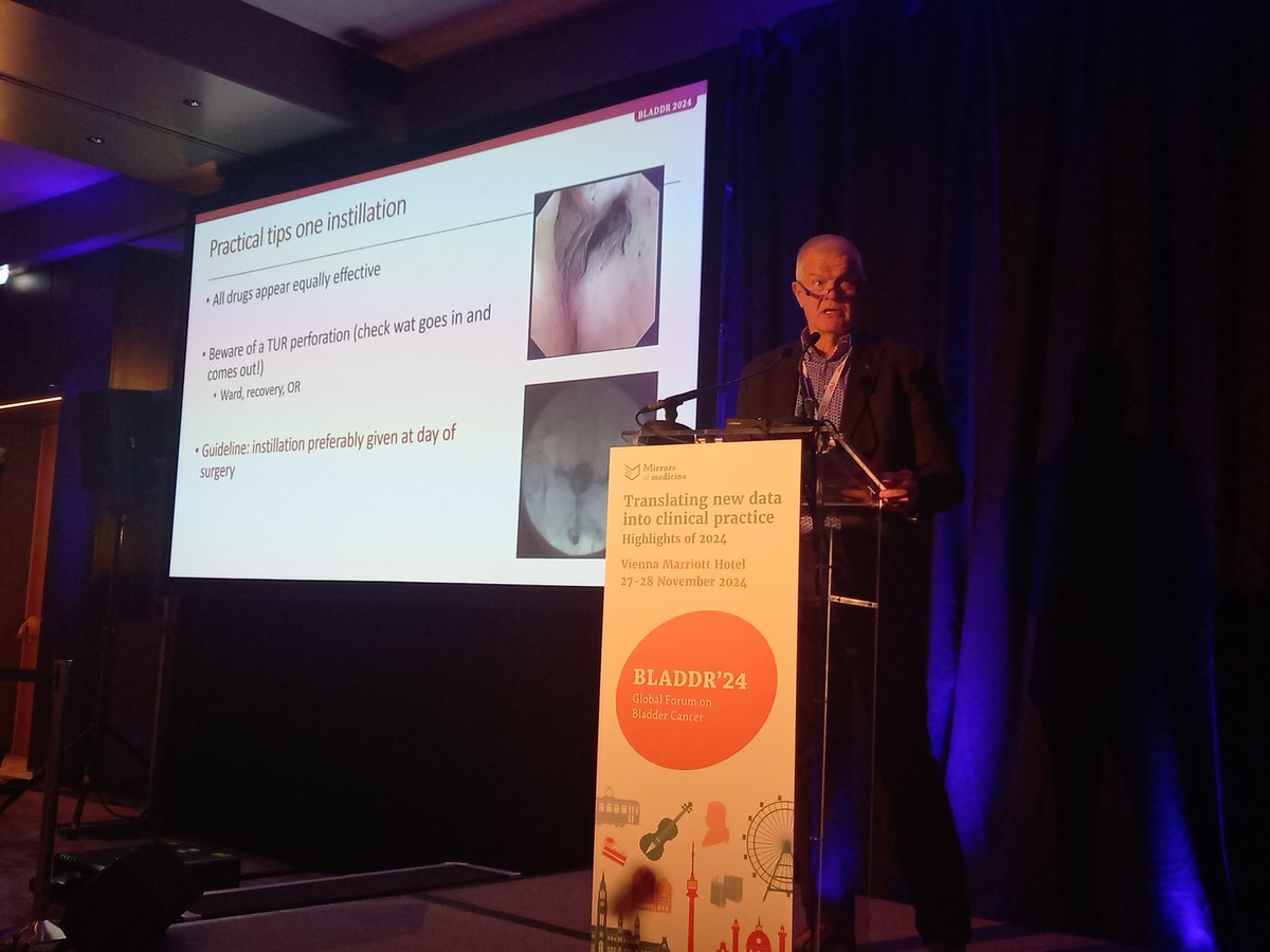 Mirrors of Medicine (@mirrorsmed) on Twitter photo Fantastic talks on practical surgical questions on DAY 2 of #BLADDR24
- Practical aspects of intravesical instillation by Fred Witjes
- The optimal TURBT by Ben-Max de Ruiter
- The impact of RC on sexual function/experience by <a href="/PignotG/">Pignot Géraldine</a>
Moderation: <a href="/CLebacle/">Cédric Lebâcle</a>
<a href="/OncoAlert/">OncoAlert</a> Fantastic talks on practical surgical questions on DAY 2 of #BLADDR24
- Practical aspects of intravesical instillation by Fred Witjes
- The optimal TURBT by Ben-Max de Ruiter
- The impact of RC on sexual function/experience by <a href="/PignotG/">Pignot Géraldine</a>
Moderation: <a href="/CLebacle/">Cédric Lebâcle</a>
<a href="/OncoAlert/">OncoAlert</a>