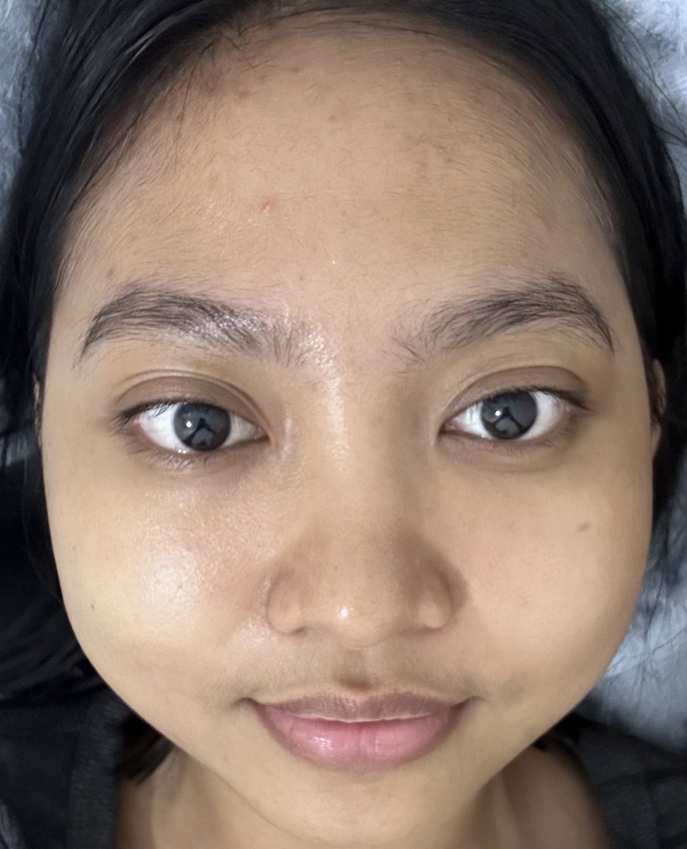 pantes sih orang orang pada ke dermies🥲 ngerti sekarang setelah cobain sendiri, ada yang bisa tebak abis berapa?

BEFORE.                                      AFTER.