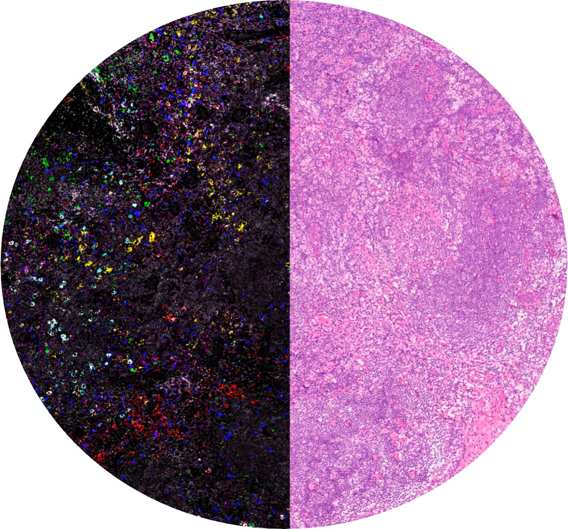 Elias Wieland (@belawieland) on Twitter photo Come and visit my poster #75 today at the <a href="/EuMacDcSoc/">European Macrophage & Dendritic Cell Society</a> #EMDS2024 meeting. We are presenting our recent work on #DC heterogeneity in #melanoma draining lymph nodes #SLN Come and visit my poster #75 today at the <a href="/EuMacDcSoc/">European Macrophage & Dendritic Cell Society</a> #EMDS2024 meeting. We are presenting our recent work on #DC heterogeneity in #melanoma draining lymph nodes #SLN