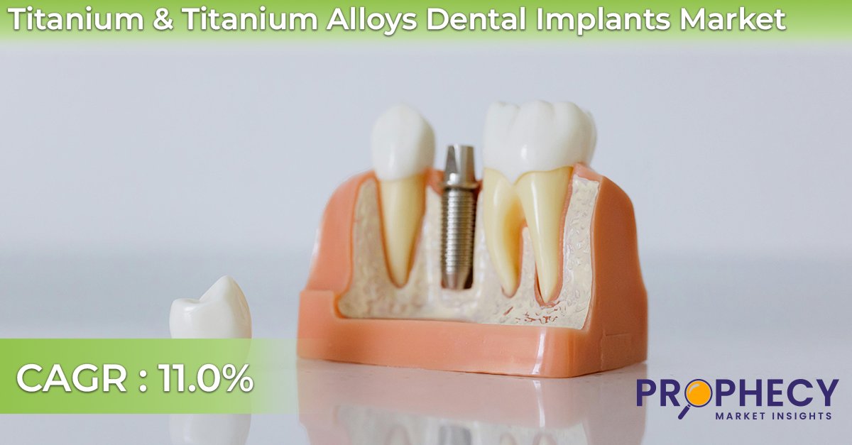 𝐓𝐢𝐭𝐚𝐧𝐢𝐮𝐦 &amp; 𝐓𝐢𝐭𝐚𝐧𝐢𝐮𝐦 𝐀𝐥𝐥𝐨𝐲𝐬 𝐢𝐧 𝐃𝐞𝐧𝐭𝐚𝐥 𝐈𝐦𝐩𝐥𝐚𝐧𝐭𝐬 𝐌𝐚𝐫𝐤𝐞𝐭: 𝐀 𝐊𝐞𝐲 𝐭𝐨 𝐒𝐭𝐫𝐨𝐧𝐠𝐞𝐫, 𝐋𝐨𝐧𝐠𝐞𝐫-𝐋𝐚𝐬𝐭𝐢𝐧𝐠 𝐒𝐦𝐢𝐥𝐞𝐬

𝑹𝒆𝒂𝒅 𝑴𝒐𝒓𝒆: lnkd.in/dDkaSSeg
