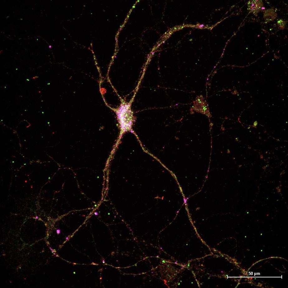 Imaging neurons today… their beauty is like a reward after weeks of hard work.